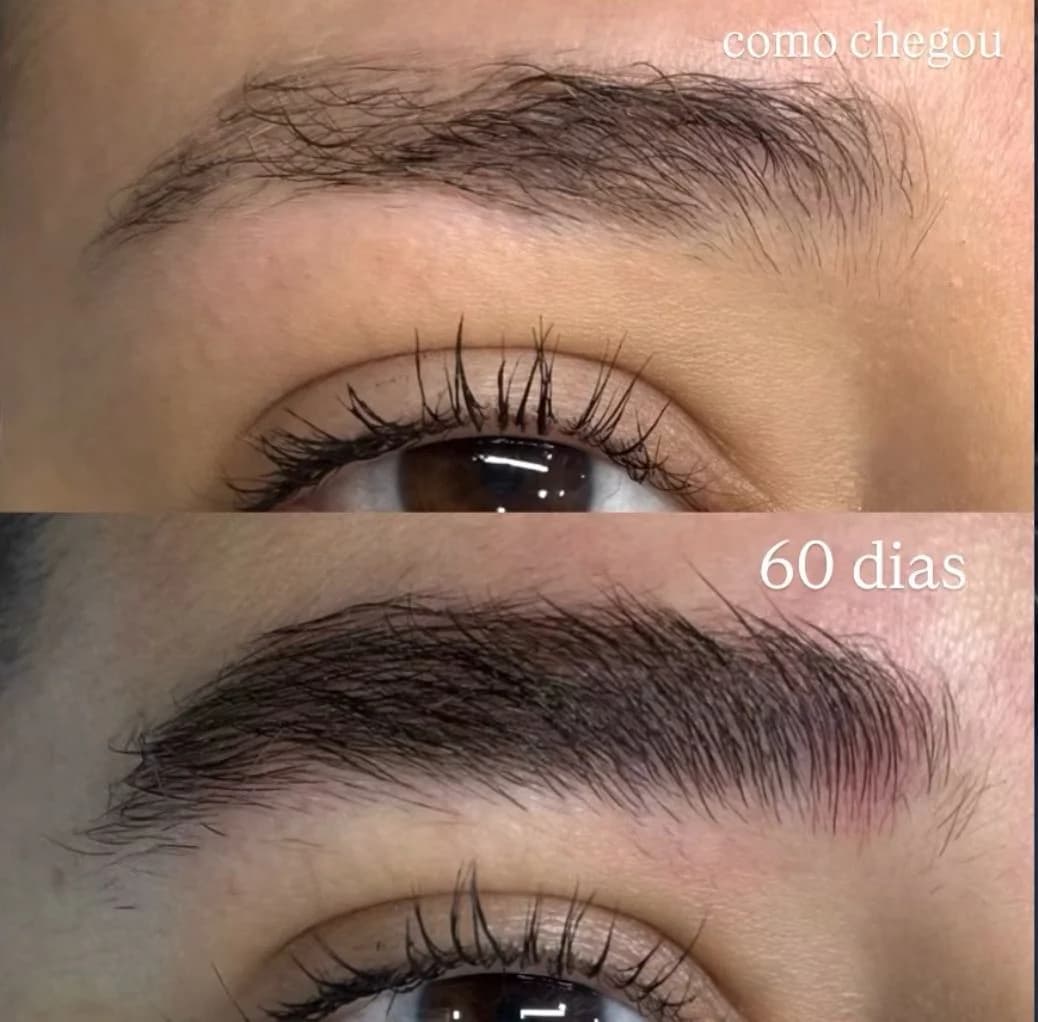 Resultado da reconstrução natural de sobrancelhas após 60 dias — ganho de densidade e harmonização do desenho das sobrancelhas com Kácia Almeida